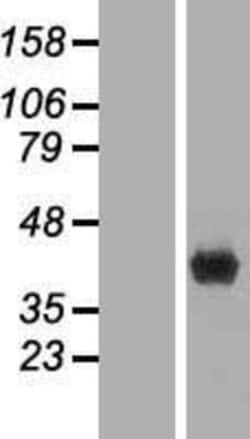 Novus Biologicals&trade;&nbsp;FBPase 1 Overexpression Lysate