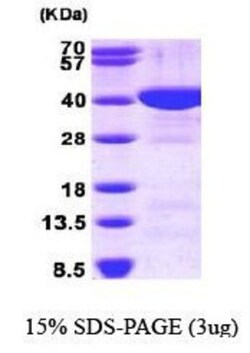 Novus Biologicals&trade;&nbsp;Recombinant Human FBPase 1 His Protein
