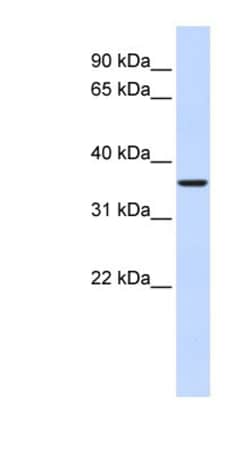 FBP2 Antibody, Novus Biologicals 0.05mg; Unlabeled:Antibodies, Polyclonal