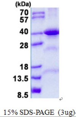 Novus Biologicals&trade;&nbsp;Recombinant Human FBP2 His Protein