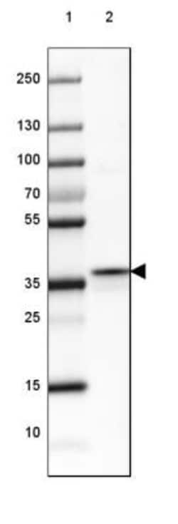 ASGPR1 Antibody, Novus Biologicals:Antibodies:Primary Antibodies