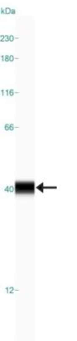 FBPase 1 Antibody, Novus Biologicals 25 &mu;L; Unlabeled:Antibodies, Polyclonal