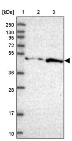 FBRS Antibody, Novus Biologicals 25 &mu;L; Unlabeled:Antibodies, Polyclonal