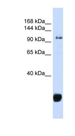 FBX10 Antibody, Novus Biologicals 0.05mg; Unlabeled:Antibodies, Polyclonal
