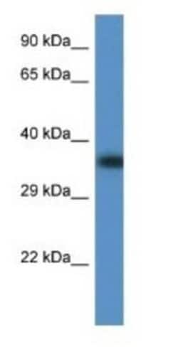 Fbx32 Antibody, Novus Biologicals:Antibodies:Primary Antibodies