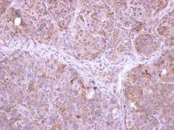 FbxL12 Antibody, Novus Biologicals 0.1mg; Unlabeled:Antibodies, Polyclonal