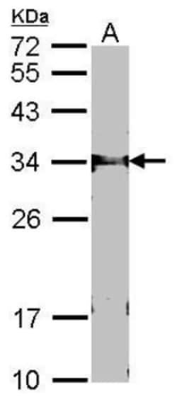 FbxL12 Antibody, Novus Biologicals 0.1mg; Unlabeled:Antibodies, Polyclonal
