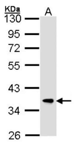 FbxL12 Antibody, Novus Biologicals 0.1mg; Unlabeled:Antibodies, Polyclonal
