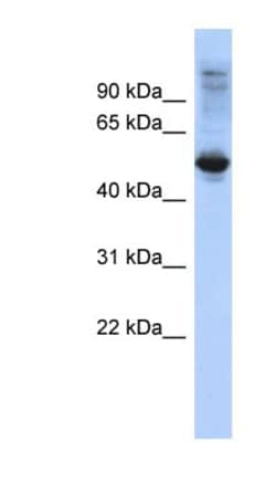FBXL16 Antibody, Novus Biologicals 100&mu;L; Unlabeled:Antibodies, Polyclonal