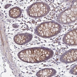 FBXL16 Antibody, Novus Biologicals 0.1 mL | Buy Online | Novus Biologicals | Fisher Scientific