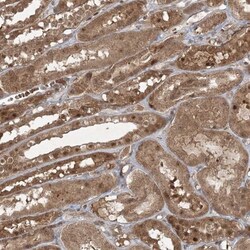 FBXL17 Antibody, Novus Biologicals 25 &mu;L, Unlabeled:Antibodies, Polyclonal