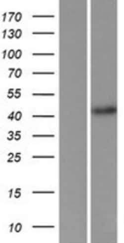 Novus Biologicals&trade;&nbsp;FBXL2 Overexpression Lysate