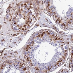 FBXL20 Antibody, Novus Biologicals:Antibodies:Primary Antibodies
