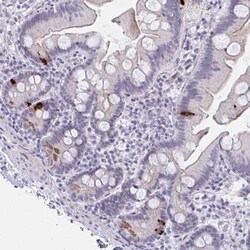 FBXL22 Antibody, Novus Biologicals 25 &mu;L, Unlabeled:Antibodies, Polyclonal