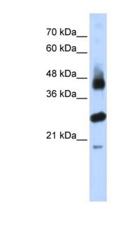 FBXL2 Antibody, Novus Biologicals:Antibodies:Primary Antibodies