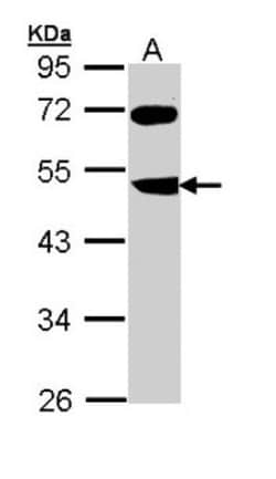 FBXL3 Antibody, Novus Biologicals 0.1mL; Unlabeled:Antibodies, Polyclonal
