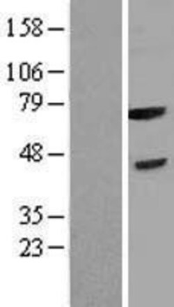 Novus Biologicals&trade;&nbsp;FBXL3 Overexpression Lysate