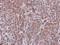 FBXL4 Antibody, Novus Biologicals 0.1mL; Unlabeled:Antibodies, Polyclonal