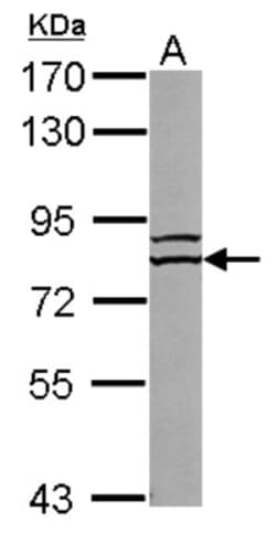 FBXL4 Antibody, Novus Biologicals 0.1mL; Unlabeled:Antibodies, Polyclonal