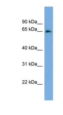 FBXL5 Antibody, Novus Biologicals 100&mu;L; Unlabeled:Antibodies, Polyclonal