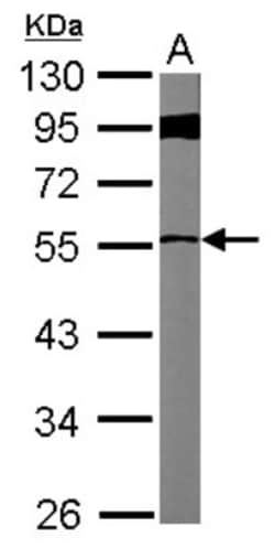 FBXL7 Antibody, Novus Biologicals 0.1mL; Unlabeled:Antibodies, Polyclonal