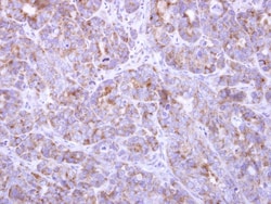 Fbxl8 Antibody, Novus Biologicals 0.1mL; Unlabeled:Antibodies, Polyclonal