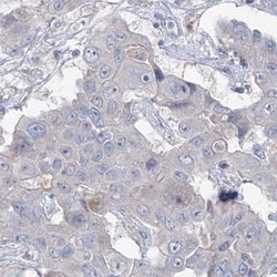 Fbxl8 Antibody, Novus Biologicals 0.1mL; Unlabeled:Antibodies, Polyclonal