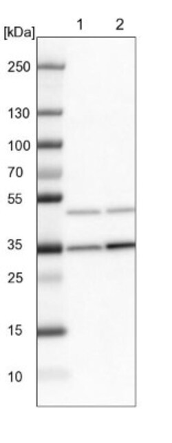 Fbxl8 Antibody, Novus Biologicals:Antibodies:Primary Antibodies