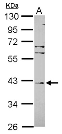 Fbxl8 Antibody, Novus Biologicals 0.1mL; Unlabeled:Antibodies, Polyclonal