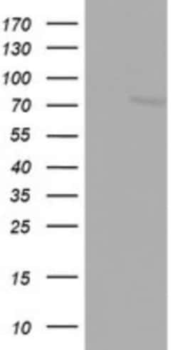 FBXO11 Antibody (OTI1F6), Novus Biologicals 0.1 mL | Buy Online | Novus Biologicals | Fisher Scientific