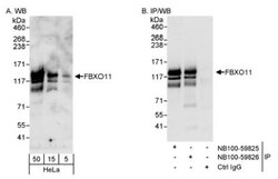 FBXO11 Antibody, Novus Biologicals 0.1mL; Unlabeled:Antibodies