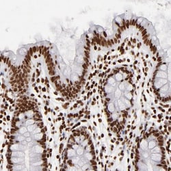 FBXO18 Antibody, Novus Biologicals 0.1mL; Unlabeled:Antibodies, Polyclonal