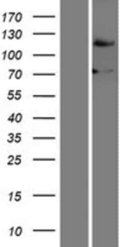 Novus Biologicals&trade;&nbsp;FBXO18 Overexpression Lysate