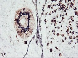 FBXO21 Antibody (OTI2C7), Novus Biologicals 0.1mL; Unlabeled:Antibodies,
