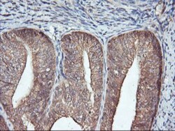 FBXO21 Antibody (OTI2C7), Novus Biologicals 0.1mL; Unlabeled:Antibodies,
