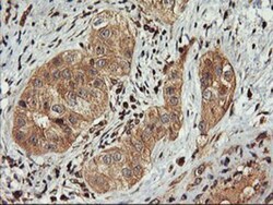 FBXO21 Antibody (OTI2C7), Novus Biologicals 0.1mL; Unlabeled:Antibodies,