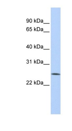 FBXO22 Antibody, Novus Biologicals 100&mu;L; Unlabeled:Antibodies, Polyclonal