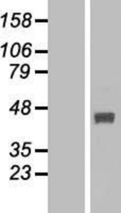 Novus Biologicals&trade;&nbsp;FBXO22 Overexpression Lysate