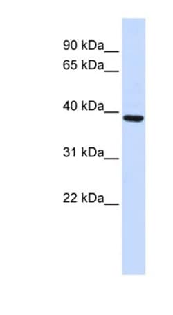 FBXO24 Antibody, Novus Biologicals 20&mu;L; Unlabeled:Antibodies, Polyclonal