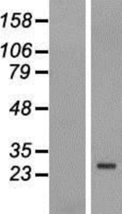 Novus Biologicals&trade;&nbsp;FBXO25 Overexpression Lysate