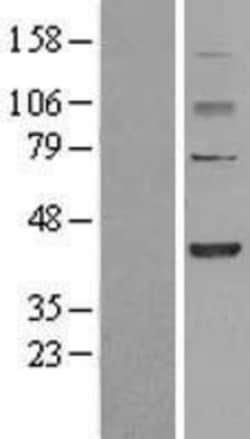 Novus Biologicals&trade;&nbsp;FBXO28 Overexpression Lysate
