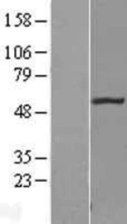 Novus Biologicals&trade;&nbsp;FBXO3 Overexpression Lysate