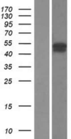 Novus Biologicals&trade;&nbsp;FBXO31 Overexpression Lysate