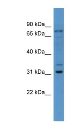FBXO34 Antibody, Novus Biologicals 100μL; Unlabeled:Antibodies, Polyclonal
