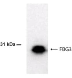 FBXO44 Antibody, Novus Biologicals 0.1 mg; Unconjugated:Antibodies, Polyclonal