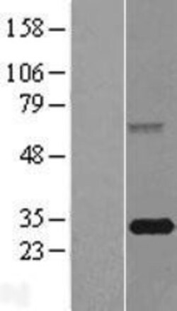 Novus Biologicals™ FBXO44 Overexpression Lysate