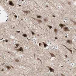 FBXO44 Antibody, Novus Biologicals:Antibodies:Primary Antibodies