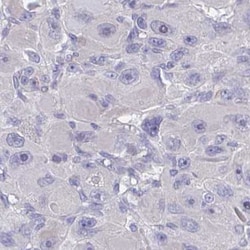FBXO47 Antibody, Novus Biologicals 25 &mu;L | Buy Online | Novus Biologicals | Fisher Scientific