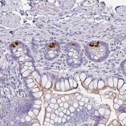 FBXO47 Antibody, Novus Biologicals 25 &mu;L | Buy Online | Novus Biologicals | Fisher Scientific