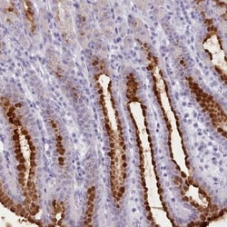 FBXO48 Antibody, Novus Biologicals:Antibodies:Primary Antibodies